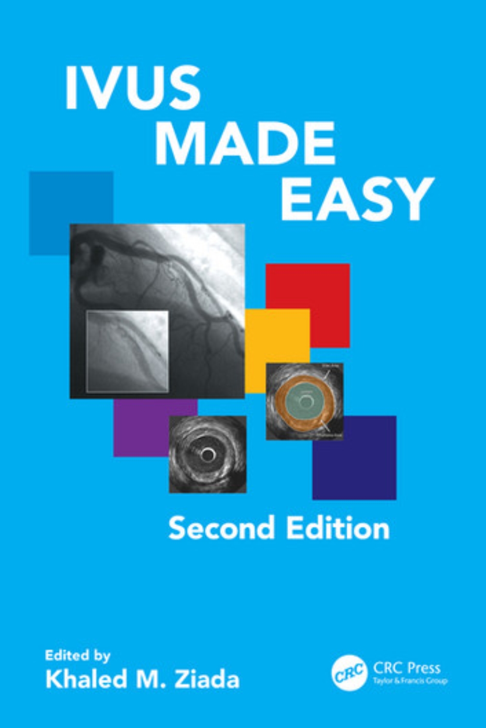 IVUS Made Easy motoono.com
