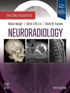 Neuroradiology: The Requisites E-Book: The Core Requisites 1 Neuroradiology: The Requisites E-Book: The Core Requisites